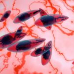 toxoplasmose_MyAfricaInfos