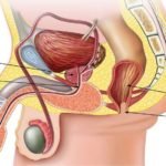 Prostate_MyAfricaInfos
