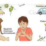 Asthma_MyAfricaInfos